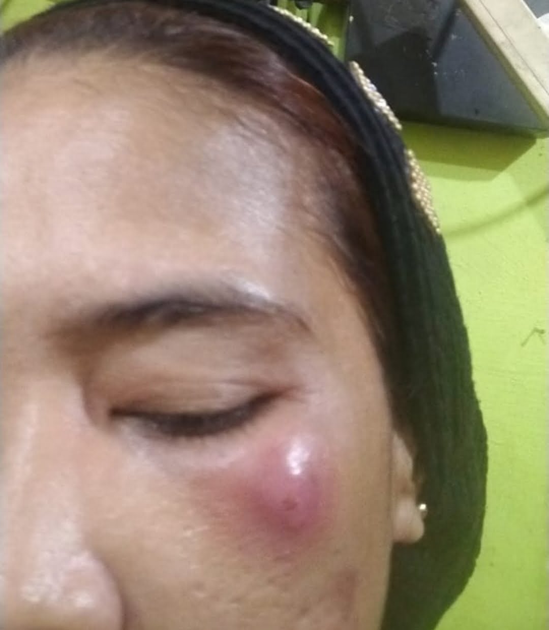 Korban Kosmetik Racikan Merk MH, Akhirnya Melapor Ke Polda Sulsel